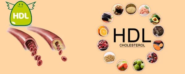 Cholesterol: Những điều cần biết về tăng cholesterol máu