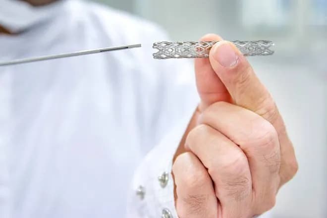 Stent động mạch vành tồn tại bao lâu trong cơ thể