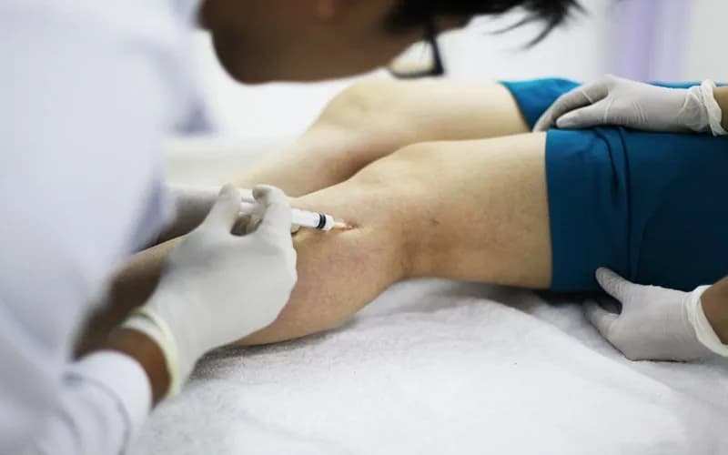 Chích xơ tĩnh mạch điều trị suy tĩnh mạch