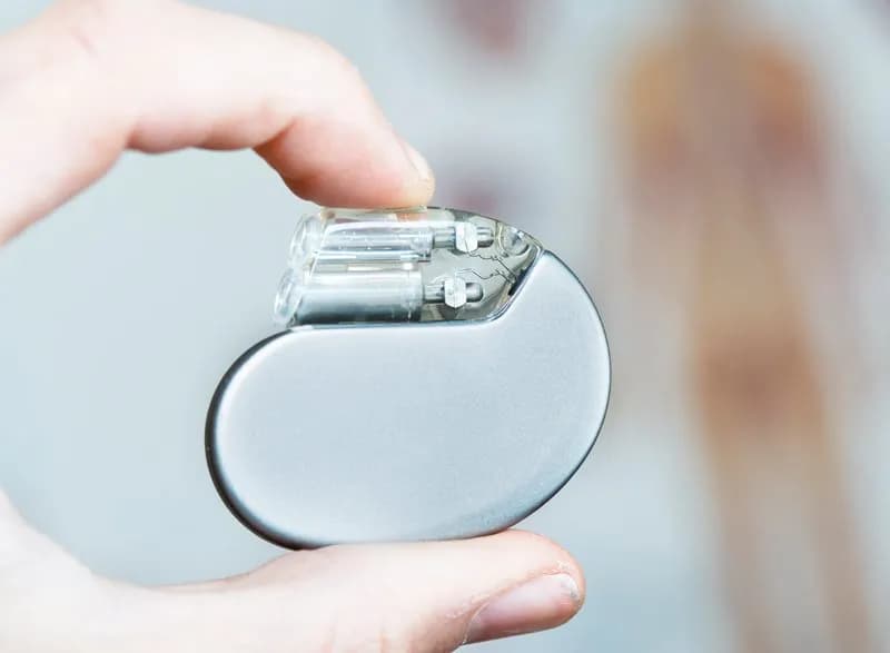 Rối loạn nhịp tim và rối loạn dẫn truyền