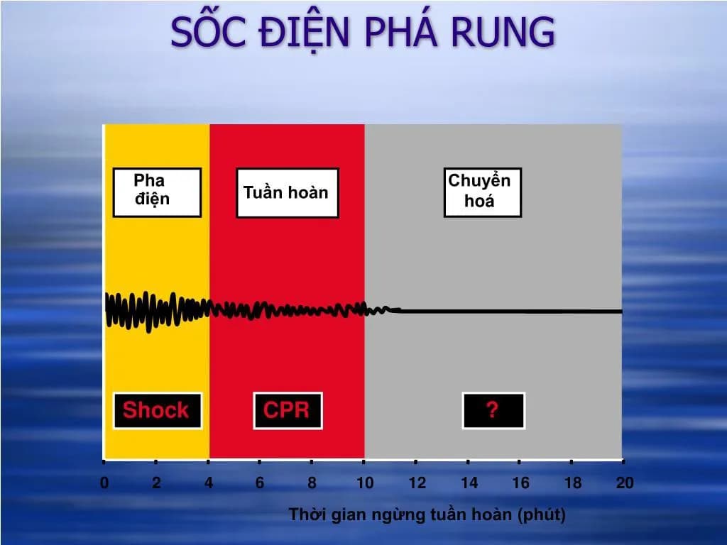 Sốc điện trong điều trị rối loạn nhịp tim