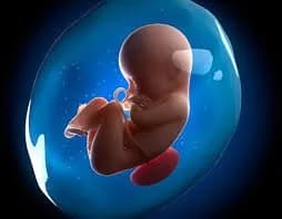 Thông liên thất, teo van và động mạch phổi