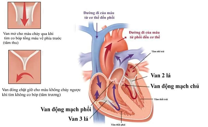 Vôi hóa van tim: Triệu chứng và điều trị