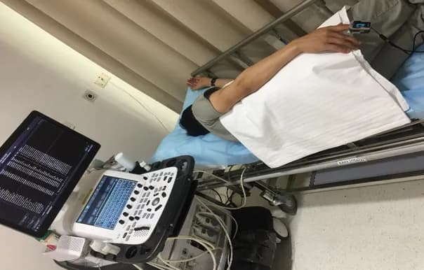 Siêu âm tim qua thực quản