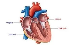 Bệnh tim bẩm sinh không tím không luồng thông