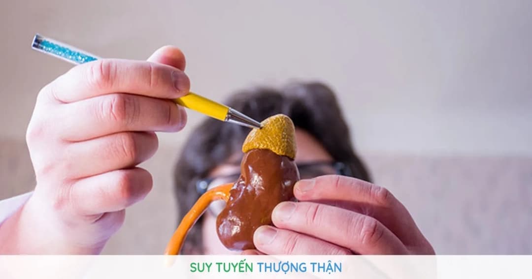 Đặc điểm và chỉ định thuốc tăng co bóp cơ tim