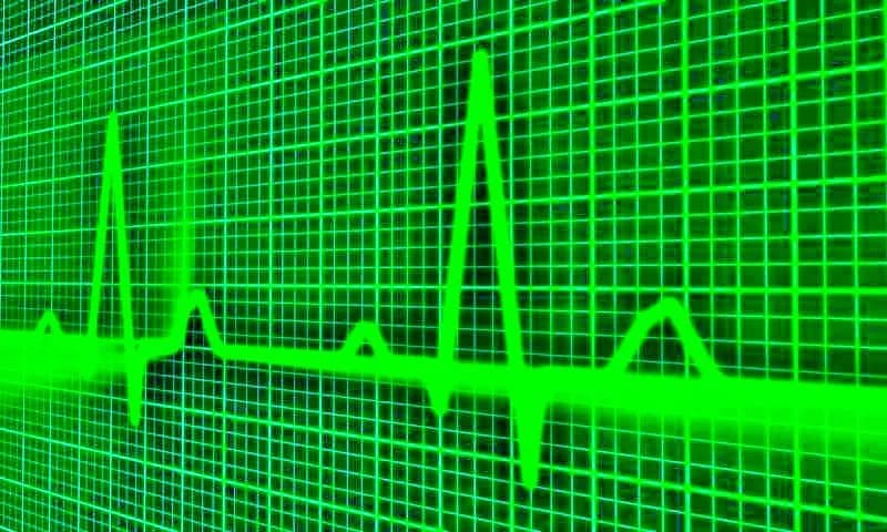 Kết quả điện tâm đồ rối loạn nhịp tim