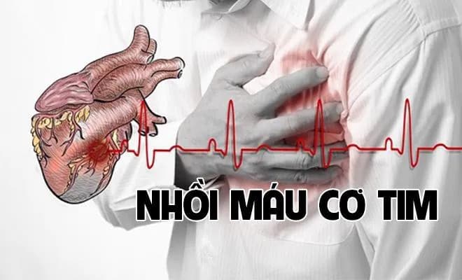 Vì sao nên thay van động mạch chủ qua da (TAVI) điều trị hở - hẹp động mạch chủ tại Vinmec?