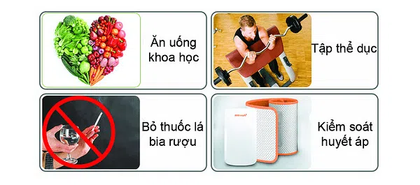 Cách phòng đề phòng bệnh mạch vành