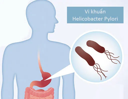 Vi khuẩn HP