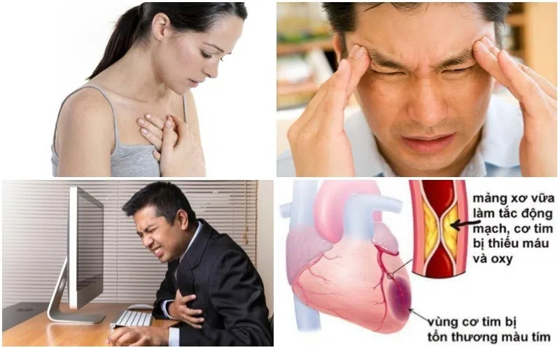 triệu chứng bệnh mạch vành