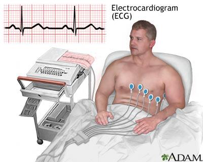 3. Ứng Dụng Của Điện Tim ECG Trong Chẩn Đoán Y Khoa