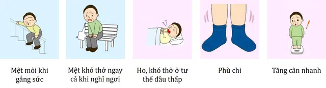Các dấu hiệu điển hình của suy tim Các dấu hiệu điển hình của suy tim